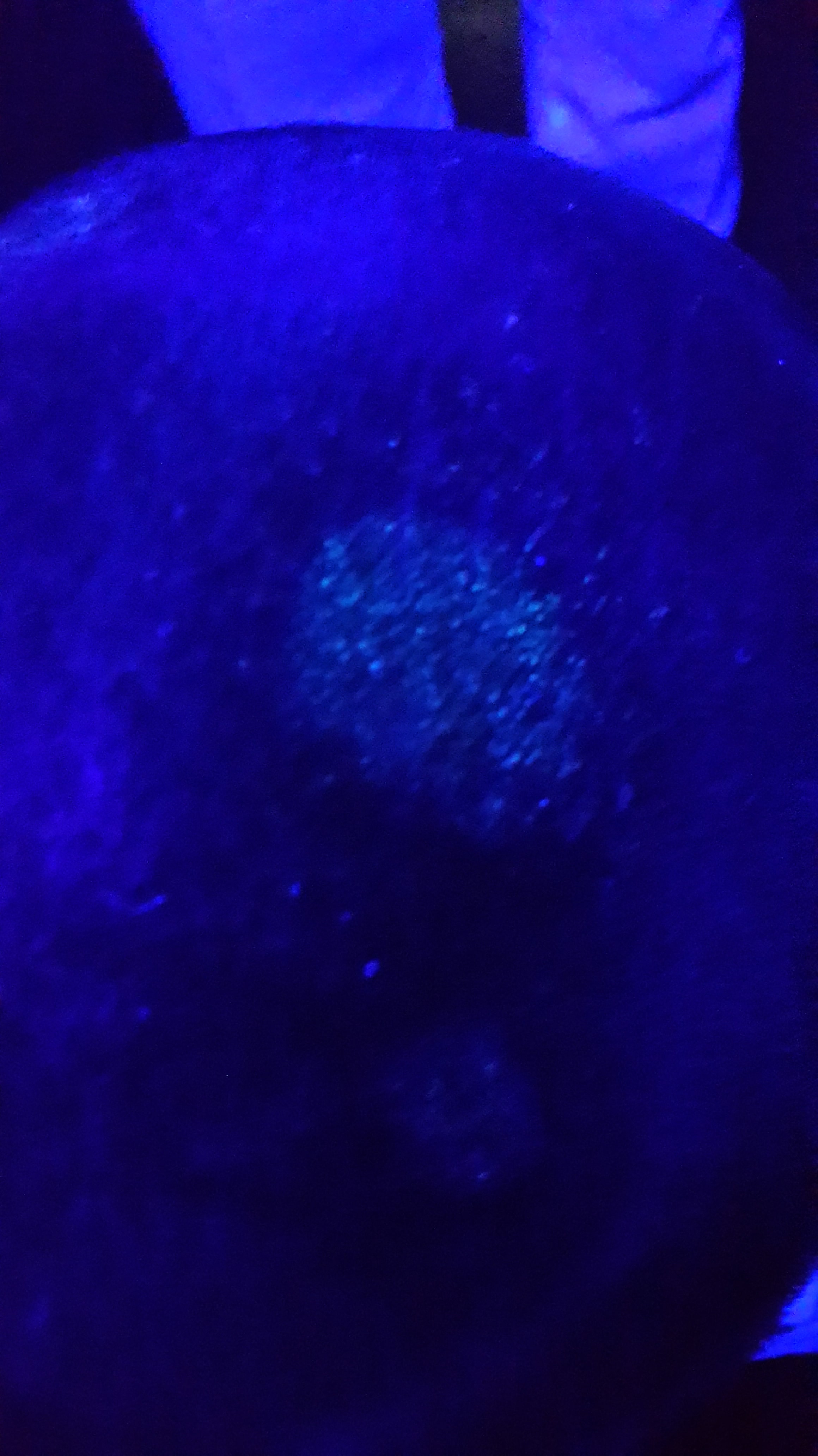 TINEA CABEZA