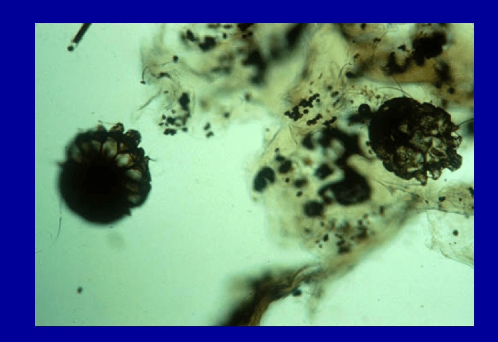 SSARCOPTES SCABIEI -HEMBRAS