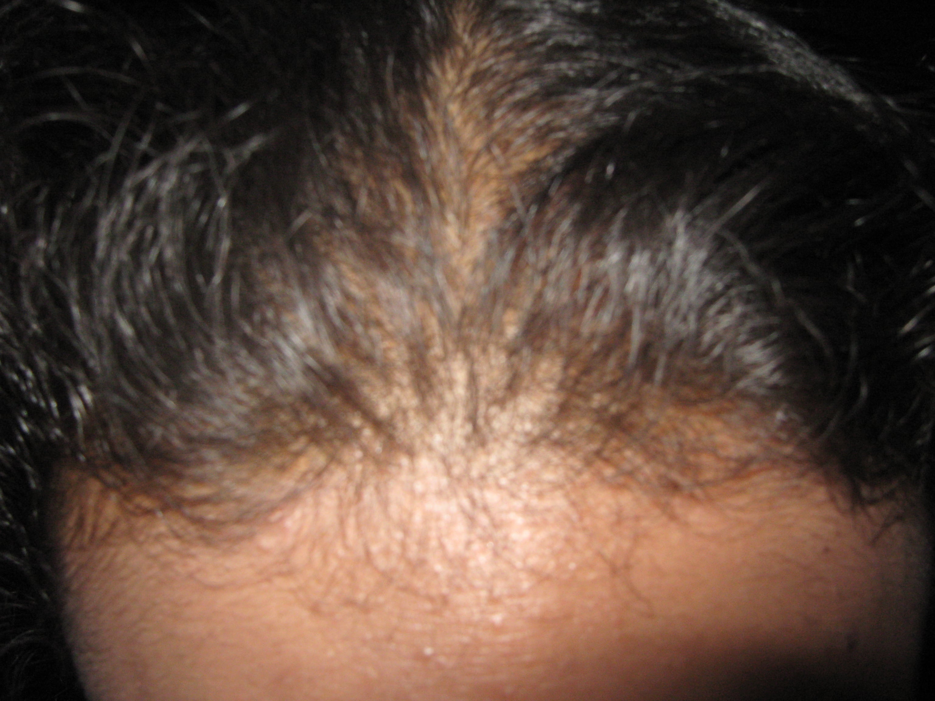 MUDA FISIOLOGICA - Adolescente