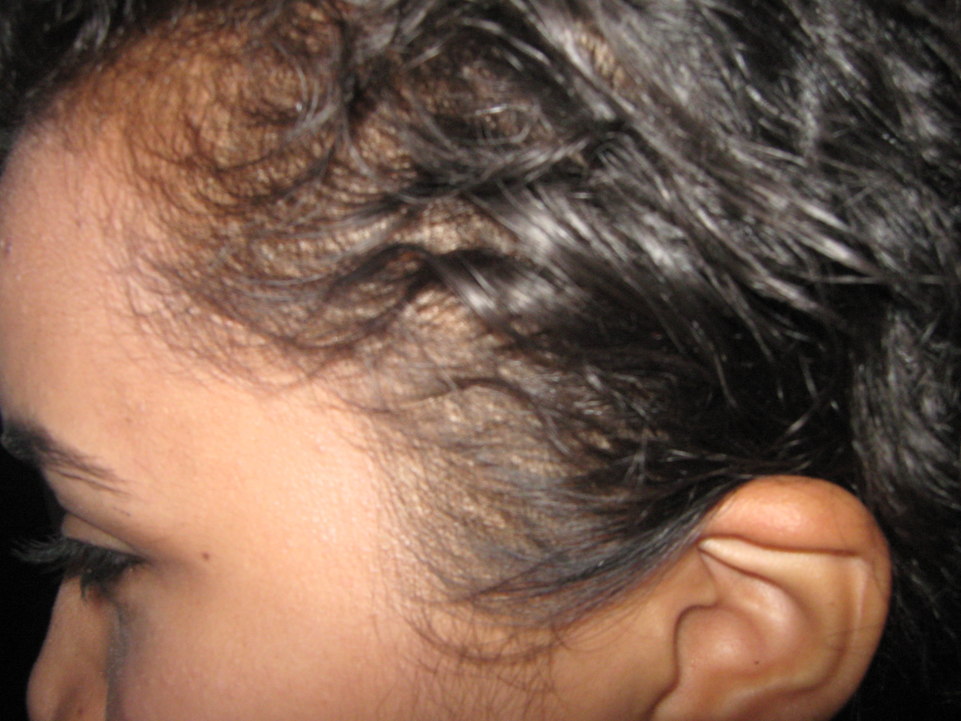 MUDA FISIOLOGICA - Adolescente