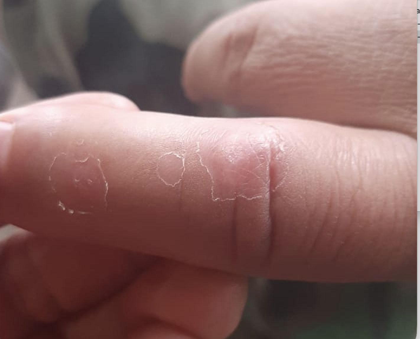 NODULO DE LOS ORDEÑADORES