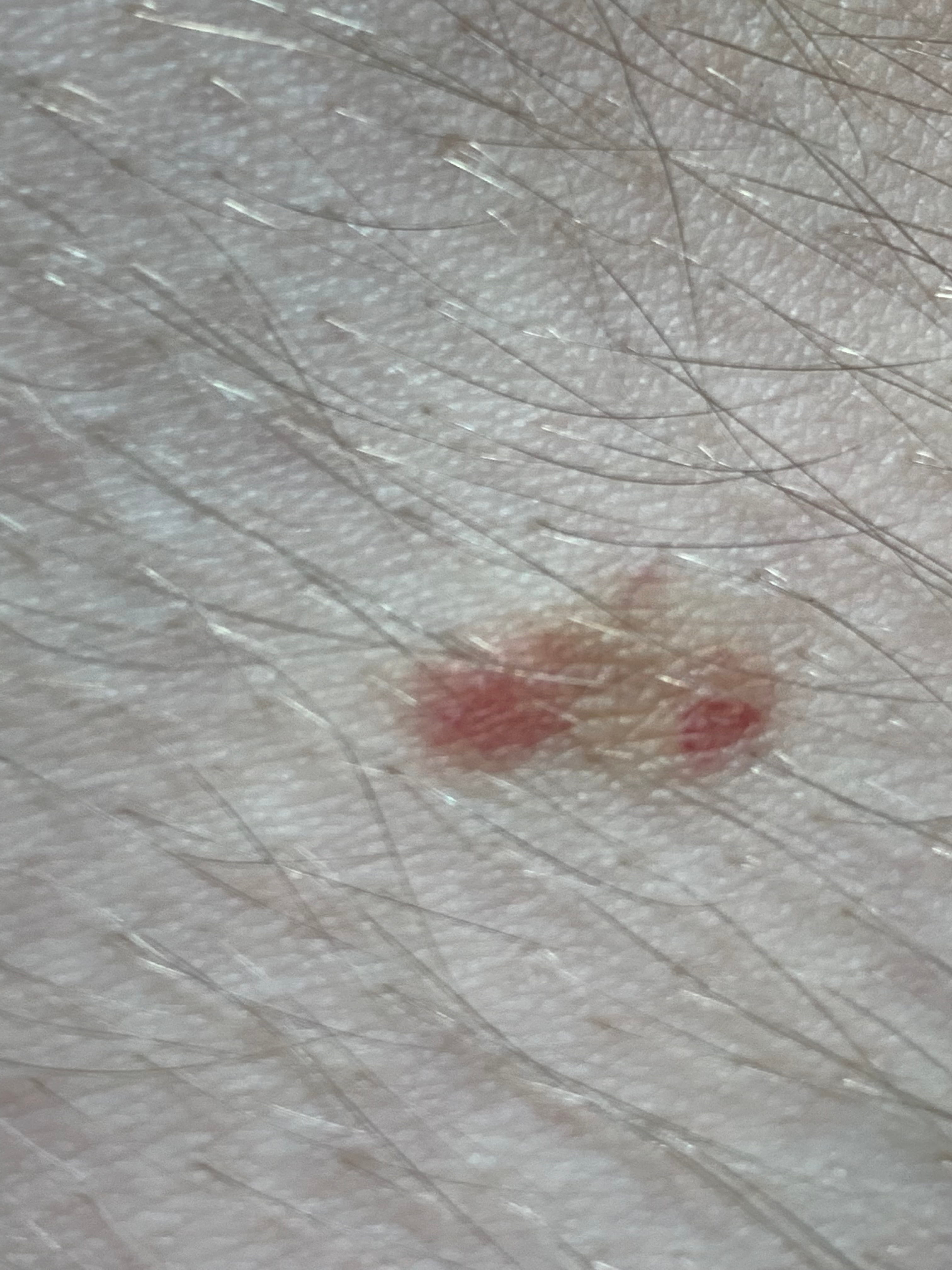 LIQUEN AUREUS