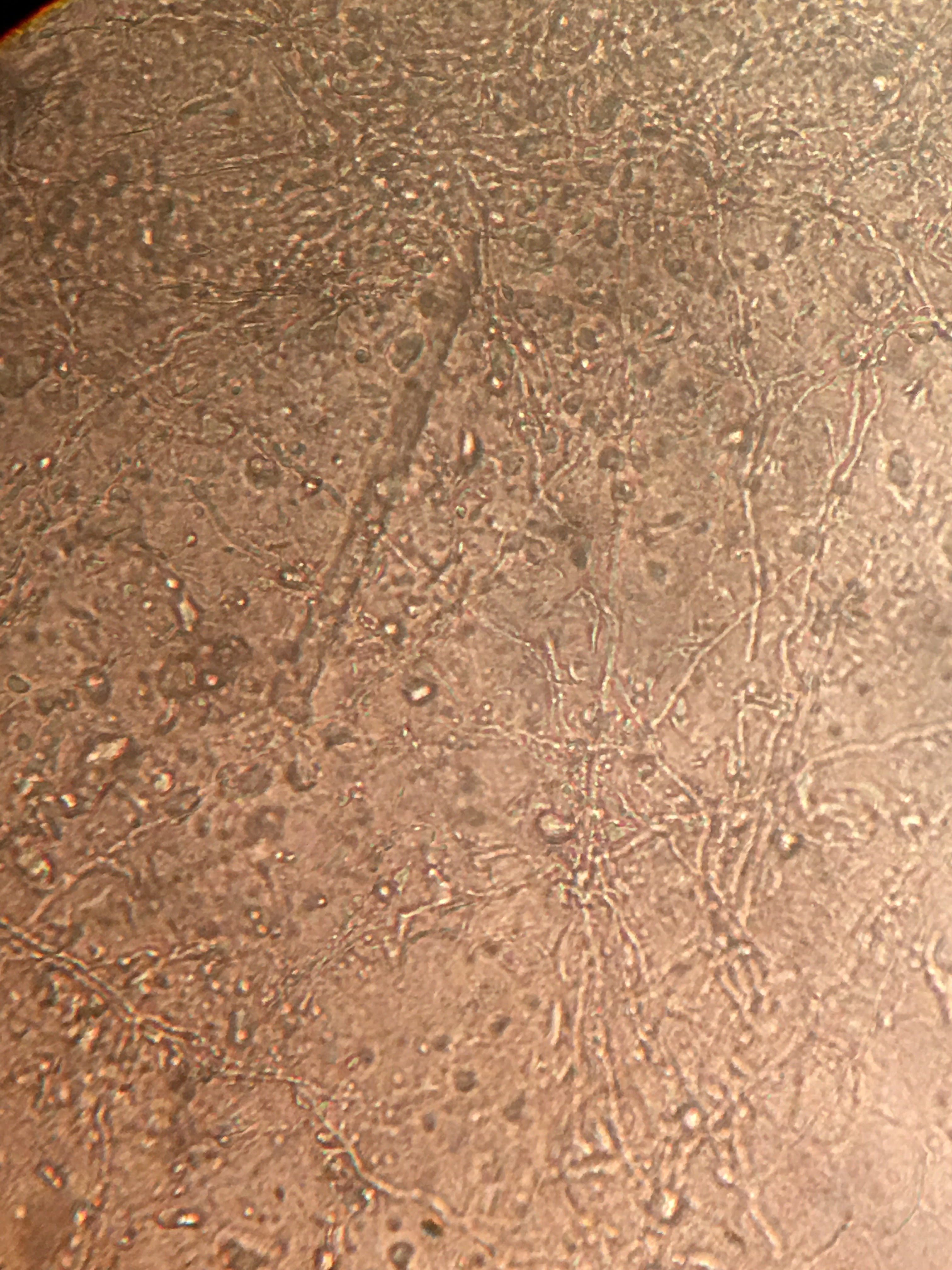 TIÑA DEL CUERPO - KOH