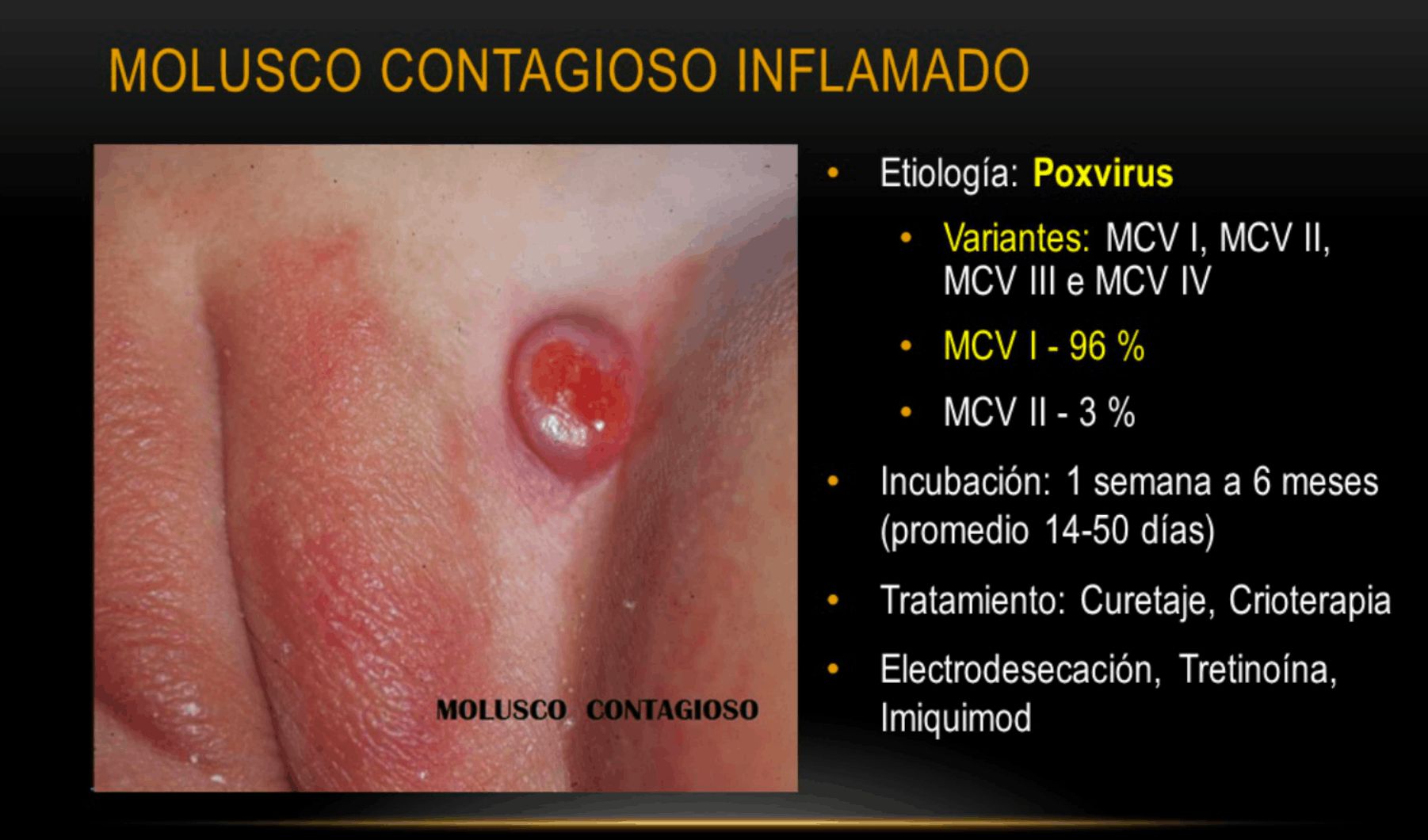 MOÑUSCO CONTAGIOSO vulvar
