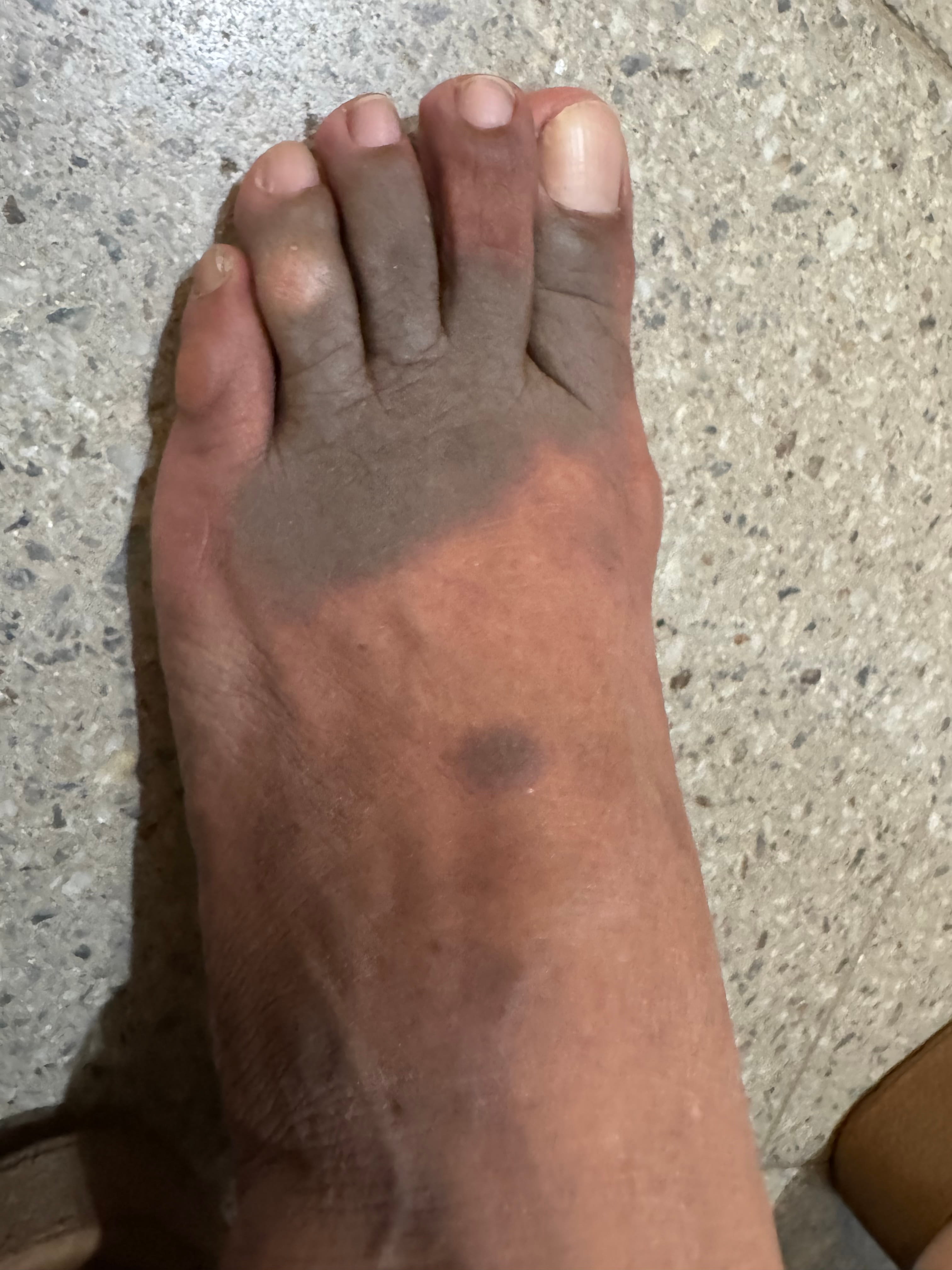 ERIREMA PIGMENTADO FIJO por Naproxeno